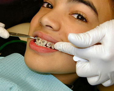 Kids Charlotte: Orthodontists - Fun 4 Charlotte Kids