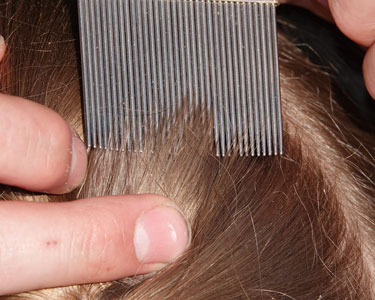 Kids Charlotte: Lice Treatment - Fun 4 Charlotte Kids