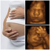 Video Prenatal 3D and 4D Ultrasound